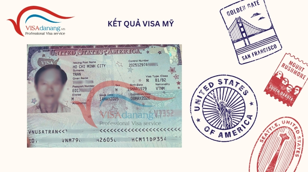 ket qua visa my1